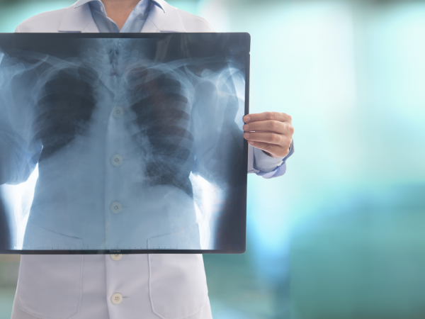 radiografia unisalus