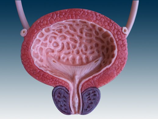 sindrome-della-vescica-iperattiva