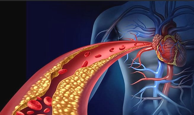 ecocolordoppler arterioso