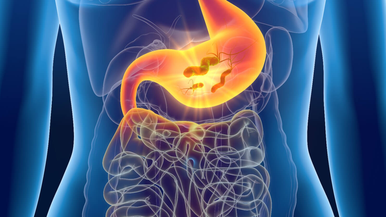 Helicobacter-Pylori