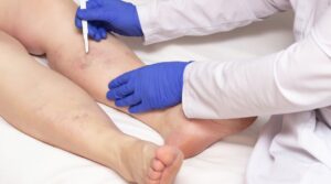 ambulatorio chirurgia vascolare milano