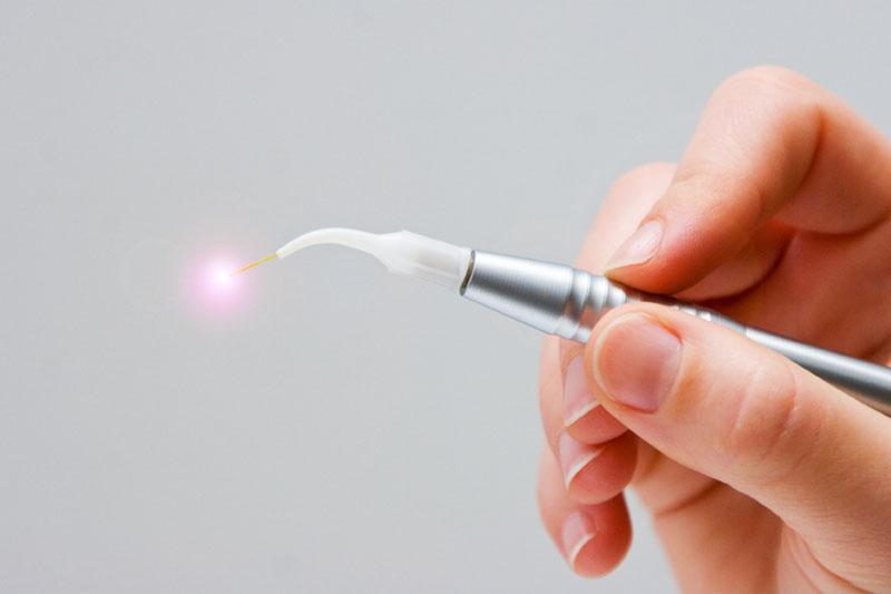 laserchirurgia