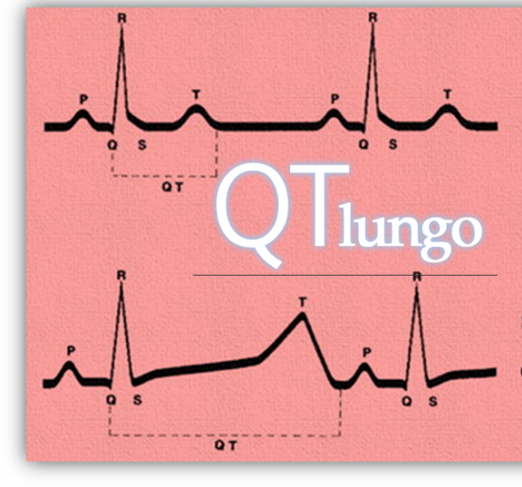 sindrome del QT lungo
