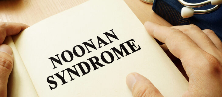 sindrome_di_noonan