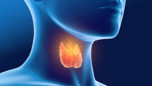 Ipertiroidismo: Quali Sono i Sintomi da Monitorare?